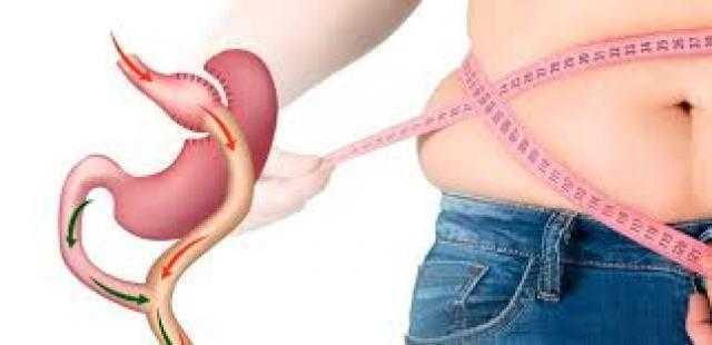 دكتور كريم صبرى: تحويل مسار المعدة ليس لإنقاص الوزن فقط