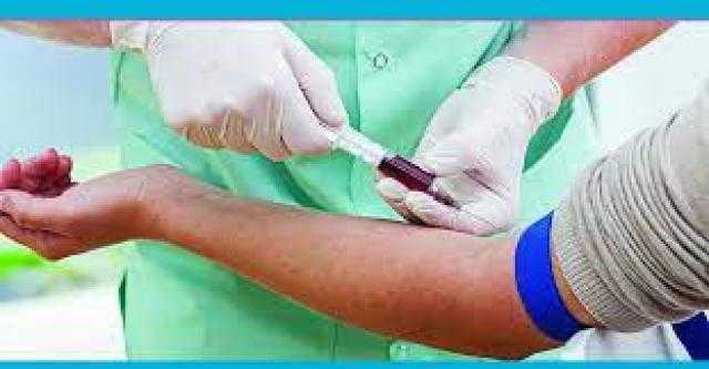 بسبب الإيدز.. إليك معلومة مهمة عن مصابي فيروس «سي»