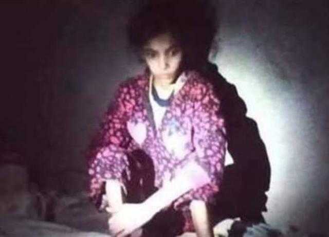 يخشى عليها من الانحراف.. أب يقيد طفلته «بجنازير» لمدة 3 سنوات