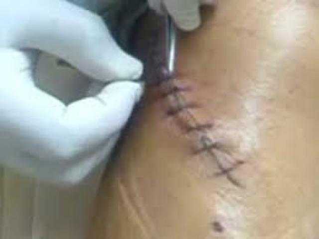 بسبب قطعة بيتزا.. طالب يطعن زميله بسلاح أبيض