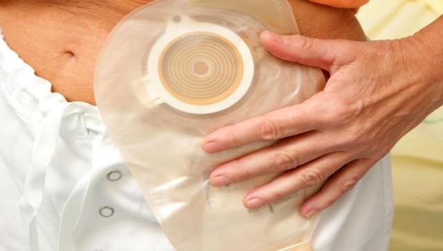 ما حكم صلاة المريض الذي يحمل نجاسته في كيس؟ «الإفتاء» تجيب