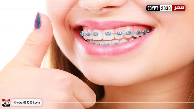 تقويم الأسنان