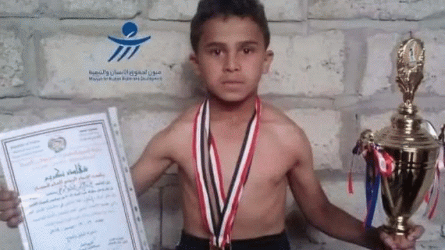  الطفل عبدالرحمن التوهمي