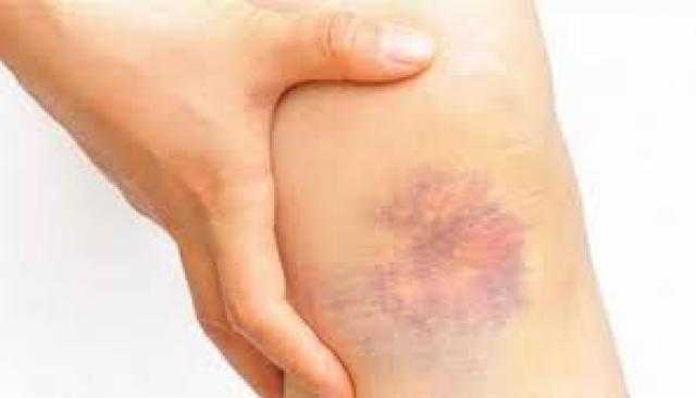 صحة الشيوخ لمصابي هذا المرض: «ملوش علاج»