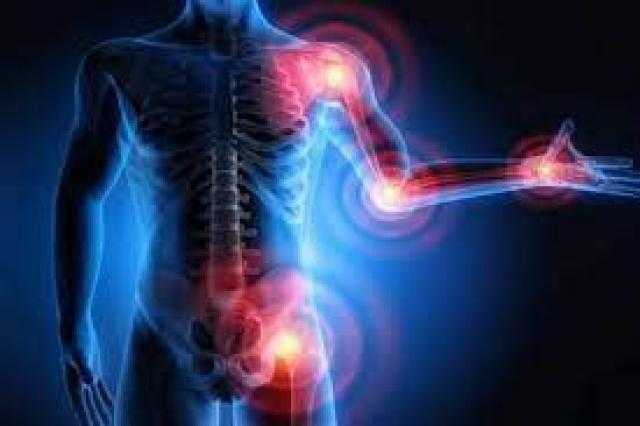 استشاري: يجب اللجوء لطبيب الروماتيزم وليس العظام في هذه الحالة