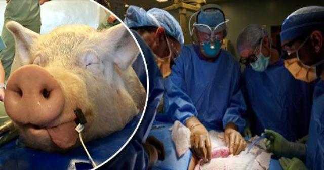 « الأعضاء متشابهة ».. أستاذ جراحة يكشف مفاجأة عن زراعة قلب خنزير للإنسان
