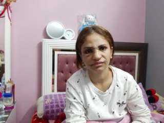 بـ165 غرزة.. ضحية زوجها بالوراق: «ضربني علقة موت» (فيديو)