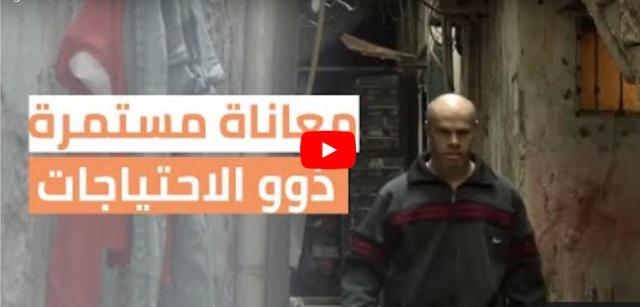 ناشطة: الأونروا لا تملك برامج للاهتمام بذوي الاحتياجات الخاصة