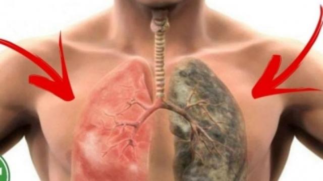 رئة مدمرة من التدخين وأخرى سليمة