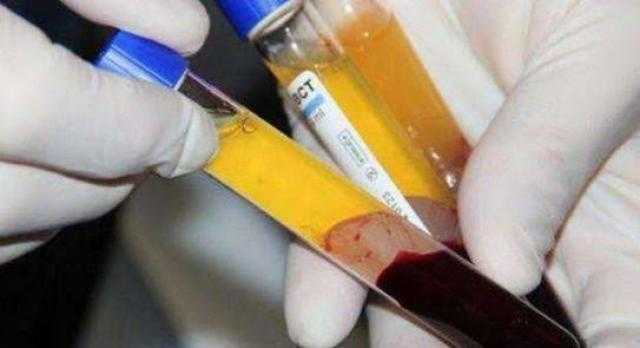 7 معلومات ترصد أخر مستجدات المشروع القومي لـ«تصنيع وتجميع مشتقات البلازما»