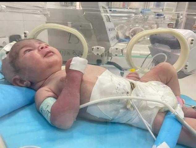 بالصور.. إنقاذ حياة طفل حديث الولادة بالتعاون بين وزارتي الصحة والتعليم العالي