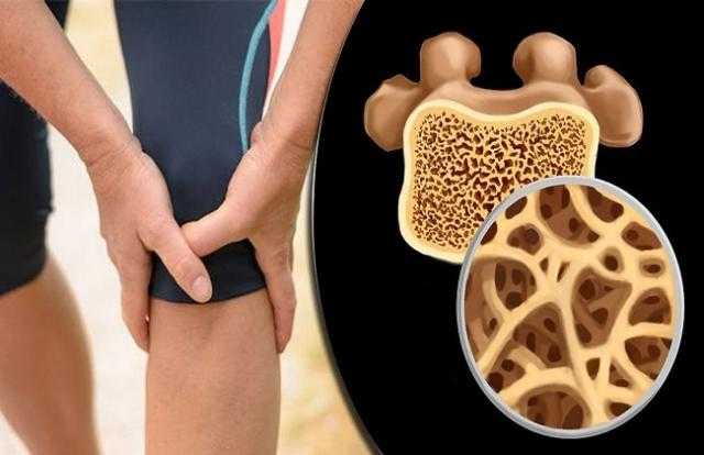 استشاري عظام يحذر من اللص الصامت (فيديو)