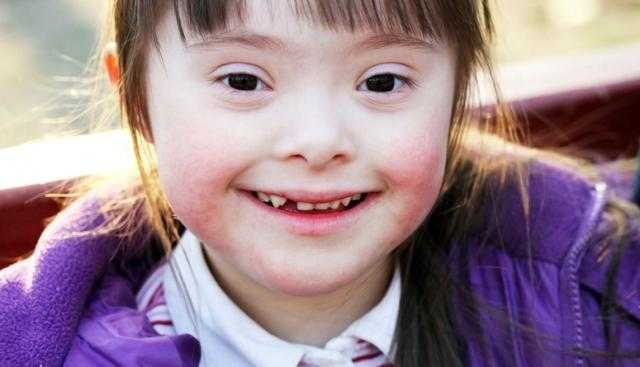 ابنتي من ذوي الهمم هل يجوز إجراء عملية لقطع «الدورة الشهرية» عنها؟