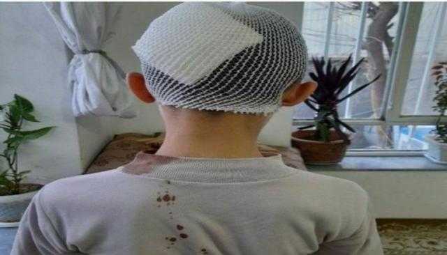 انفجار في أكبر مسجد بكابول.. وإصابة 6 أشخاص