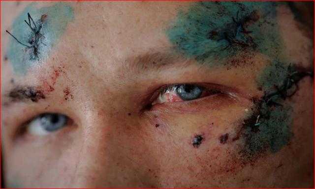 30 صورة جديدة للحرب في أوكرانيا.. مشاهد صادمة