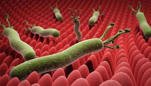 هل جرثومة المعدة خطيرة؟.. استشاري يكشف مفاجأة - «فيديو»