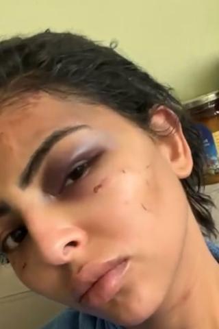 «خطف وتعذيب وهتك عرض» .. القصة الكاملة لمعاناة سيدة مصرية على يد سائق بالكويت