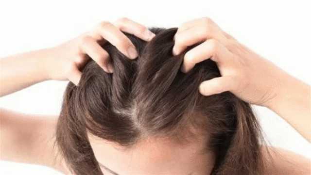 أستاذ أمراض جلدية: وباء جديد يلتهم مقدمة الرأس «فيديو»