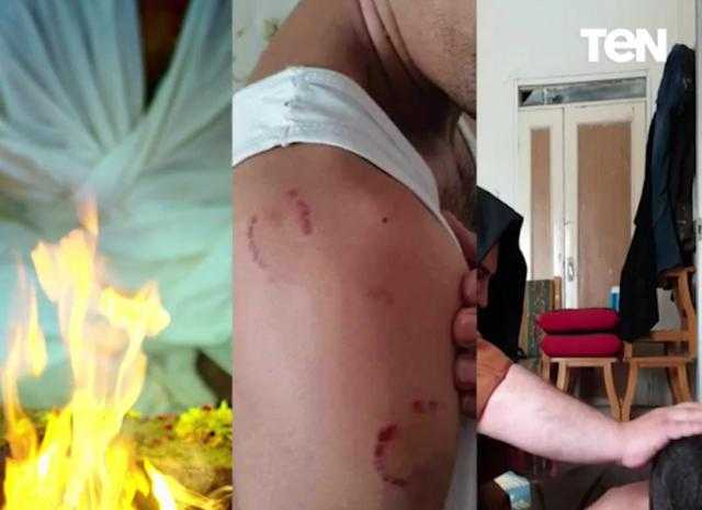 «عض وضرب وفتح راس».. شاهد: أغرب الطرق لعلاج المرضى قديمًا