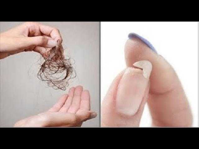 متى يصبح سقوط الشعر وتكسير الأظافر عرض خطير.. استشاري يجيب