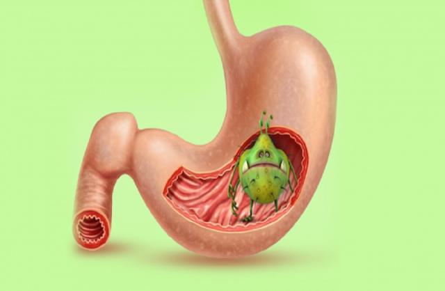 موجودة في مطبخك.. أطعمة تقضي على جرثومة المعدة نهائيا  «فيديو»