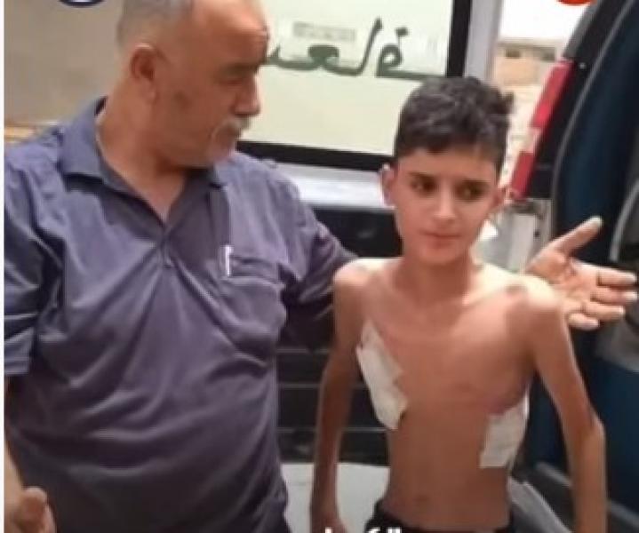 170 ألف دولار.. تبرعات لإنقاذ حياة طفل مصاب بمرض تليف الرئة «فيديو»