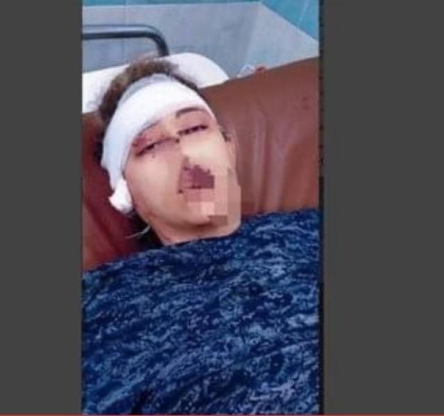 شاهد.. عامل يقطع أذن زوجته ويسدد لها 20 طعنة في حلوان