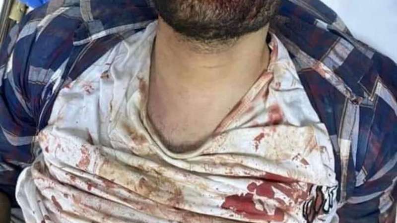ننشر أول صورة للمتهم بذبح زميلته أمام الجامعة 