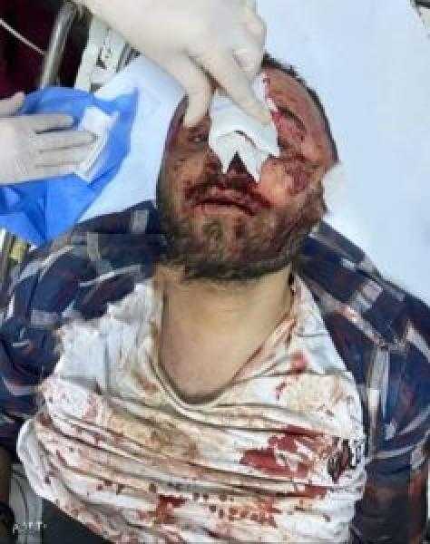 حادث المنصورة اليوم.. مفاجأة قاتل طالبة المنصورة كان هيقتل أبوه «فيديو»