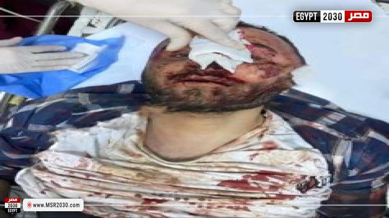 حادث المنصورة اليوم - طالبة جامعة المنصورة المقتولة