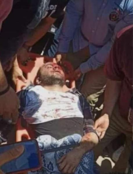 حادث المنصورة اليوم .. ننشر صورة القاتل .. بعد تلقيه «علقة موت»