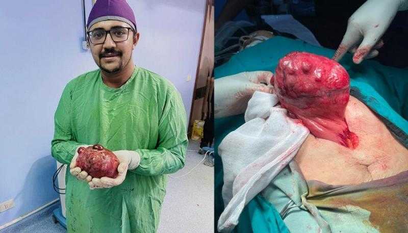 جراح يتحدى «المركزية ».. استئصال ورم ضخم لمريضة 80 عامًا في قنا