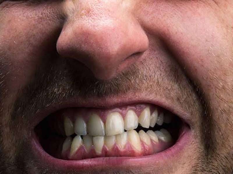 الجز على الأسنان