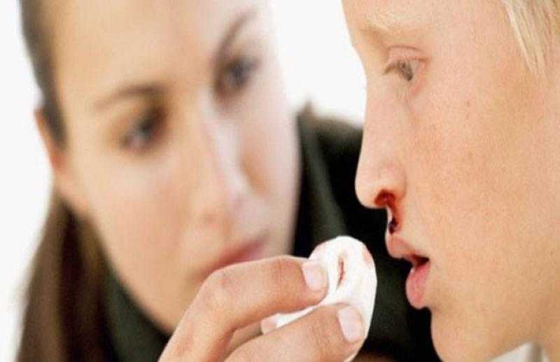 روشتة نصائح لمواجهة نزيف الأنف بالصيف - «فيديو»