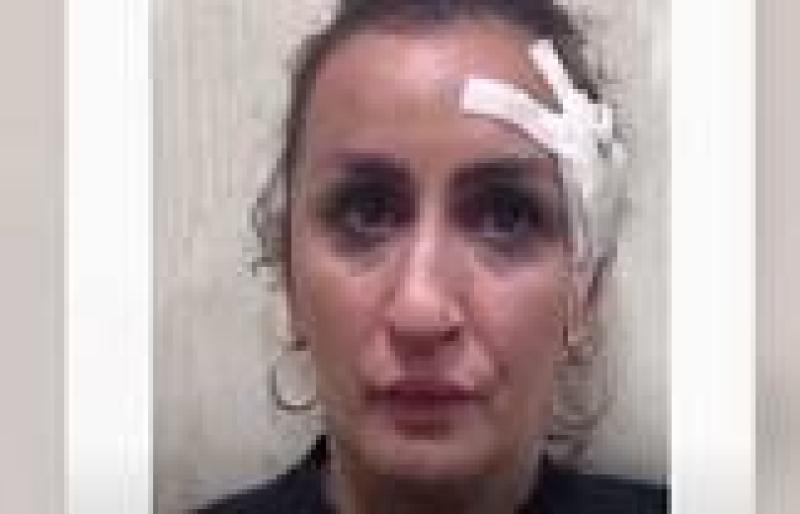 روسية تبيع طفلها لإجراء عملية تجميلية في أنفها.. شاهد