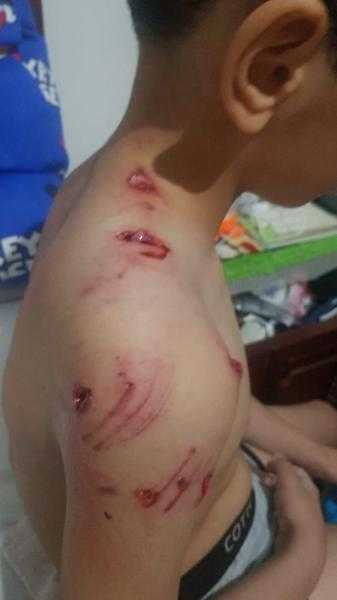 كلب ضال يمزق جسد طفل في مدينة الشروق« صور»