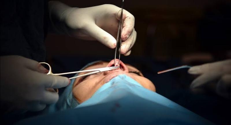 فنانة شهيرة تعلن ندمها على عمليات التجميل 