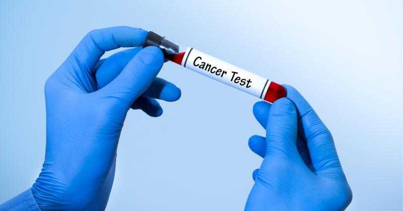 في 24 ساعة.. فحص سريع لكشف إصابتك بالسرطان «فيديو»