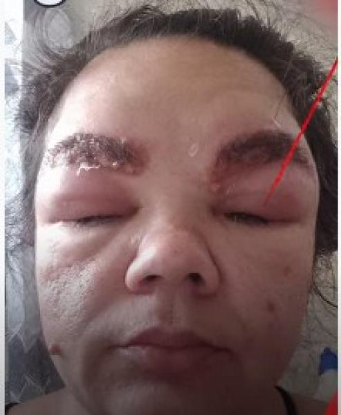 شاهد.. نهاية غير متوقعة لسيدة وضعت صبغة لحاجبيها