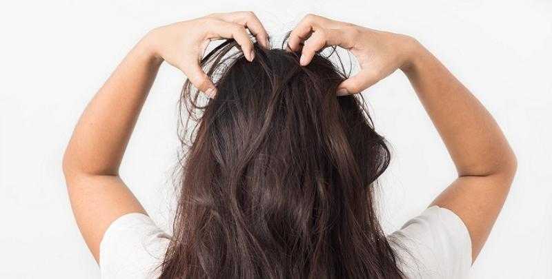 4 وصفات طبيعية للتخلص من قشرة الشعر وتقويته
