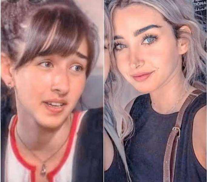 هنا الزاهد قبل وبعد 