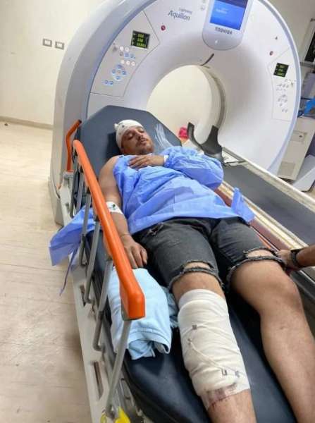 صورة الشاب المصاب 