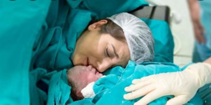 طبيب نساء وتوليد: الولادة القيصرية تؤدي لاستئصال الرحم.. فيديو