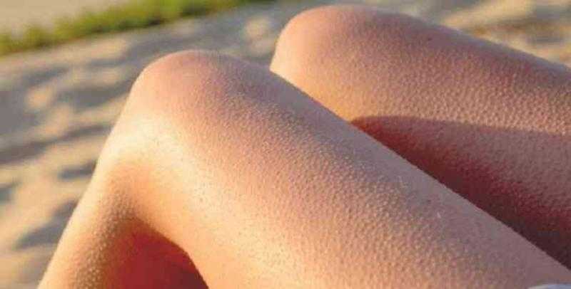 بخطوات سهلة وبسيطة تخلصي من «جلد الوزة»