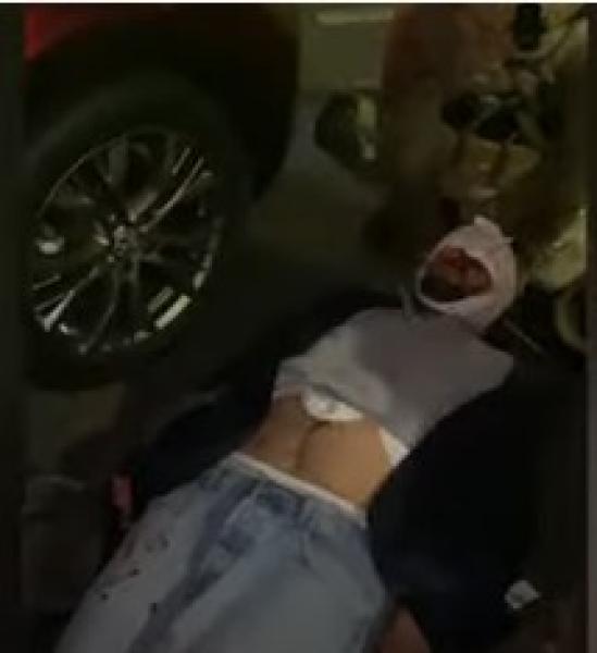 غارقا بالدماء.. أول ظهور للرجل الذي صدم الرئيس الأوكراني «فيديو»