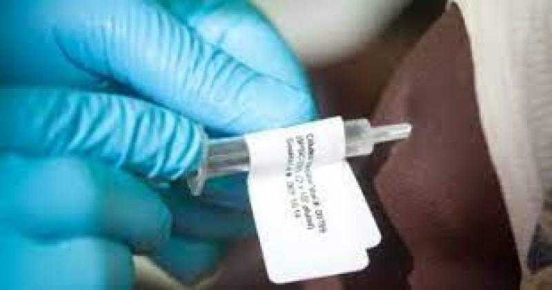 بعد تفشيه من جديد.. ارتفاع وفيات الإيبولا إلى 19 شخصا في أوغندا