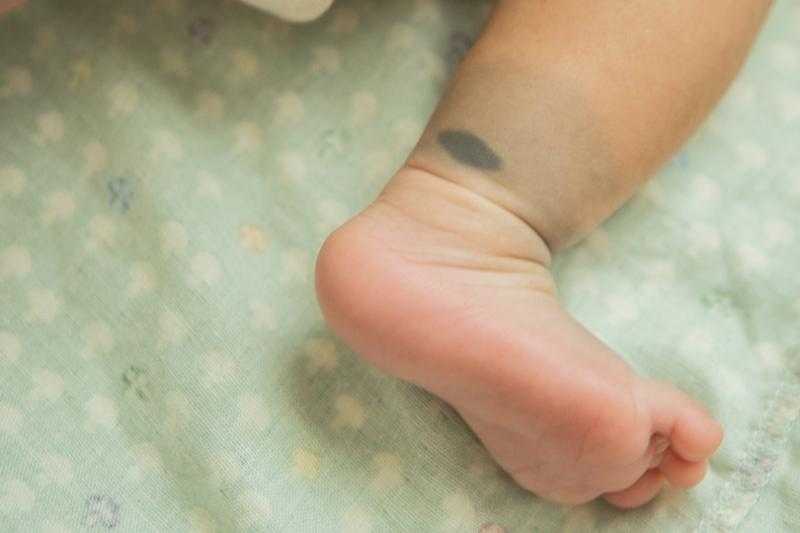 طبيب أطفال: «ظهور بقع زرقاء على جلد صغيرك تخبرك بشئ خطير»