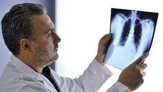 أهمية الأشعة التشخيصية في إنقاذ حياة المصابين في حوادث الطرق