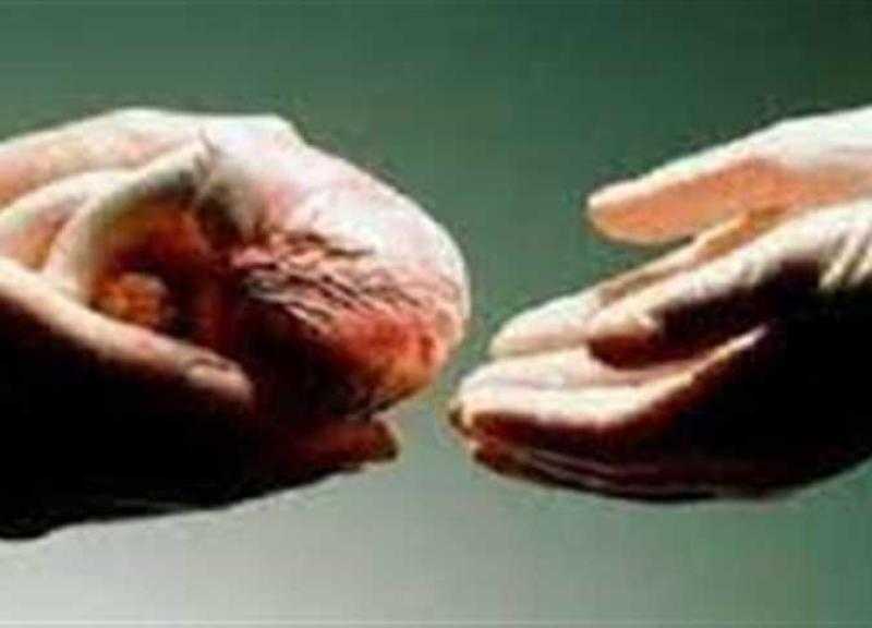 يحق للورثة الاعتراض على التبرع بأعضاء المتوفى .. اعرف الحقيقة كاملة