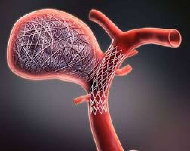 تعبيرية 